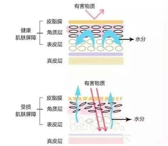 干、癢、紅、腫？別慌涂護膚品，先看看皮膚屏